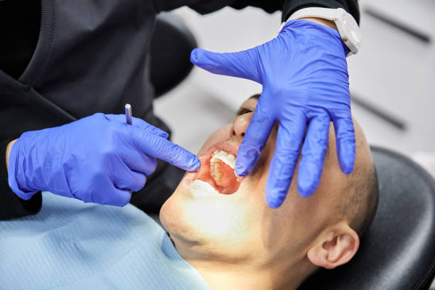 Best Emergency Dentist for Knocked-Out Tooth in Irwin, PA